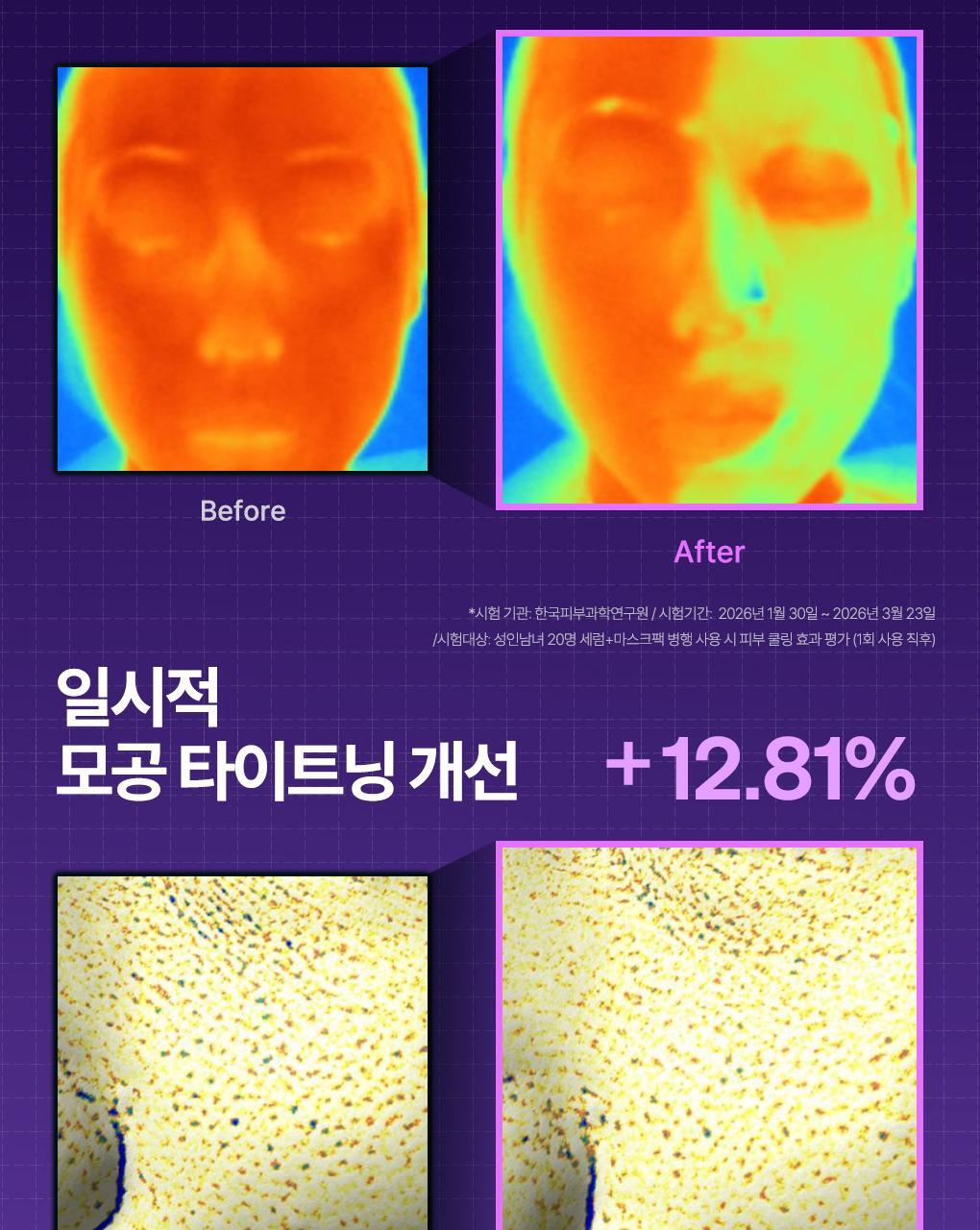 韓國 Mediheal PDRN Wrapping Serum Mask Lifting 99%純PDRN緊緻毛孔提拉包裹式精華面膜 10片裝 - 2種選擇