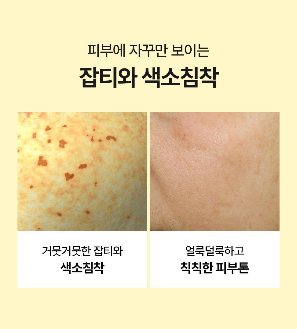 韓國 Mediheal Vitamin C Wrapping Serum Mask Brightening 99%純維C提亮淡瑕包裹式精華面膜 10片裝 - 2種選擇
