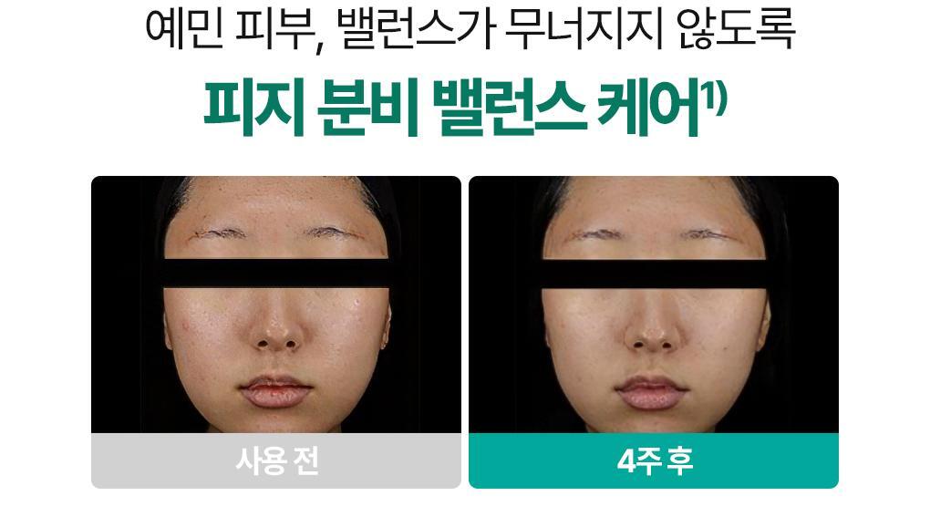 韓國 Bring Green Zinc Teca Blemish Spot Gel 鋅PCA積雪草舒緩抗痘袪痘淡印集中護理凝膠 - 15ml