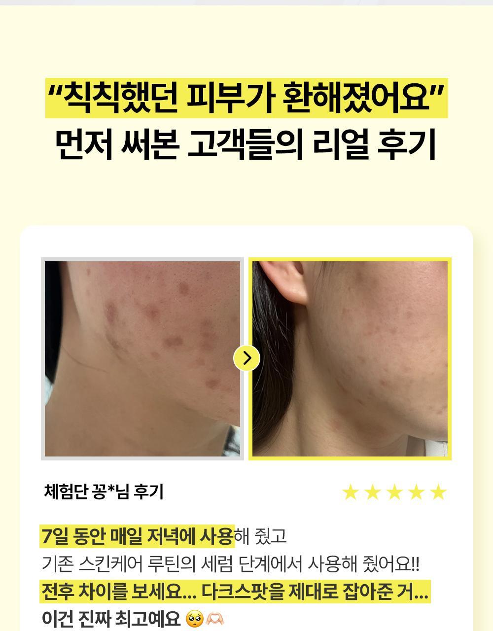 7天見效~韓國 manyo Glutathione 7 Dark Spot Serum 99%高純度奈米穀胱甘肽淡斑精華 - 30ml