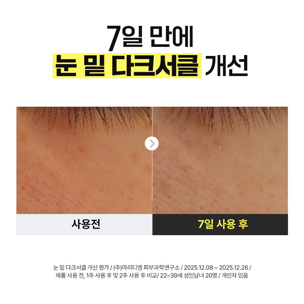 可撕式全精華面膜🌼 美白淡斑&黑眼圈~韓國 manyo Glutathione 7 Dark Spot Serum Patch 99%高純度奈米穀胱甘肽7日淡斑精華果凍面膜貼片 - 30片裝 可撕式全精華面膜🌼 美白淡斑&黑眼圈~韓國 manyo Glutathione 7 Dark Spot Serum Patch 99%高純度奈米穀胱甘肽7日淡斑精華果凍面膜貼片 - 30片裝