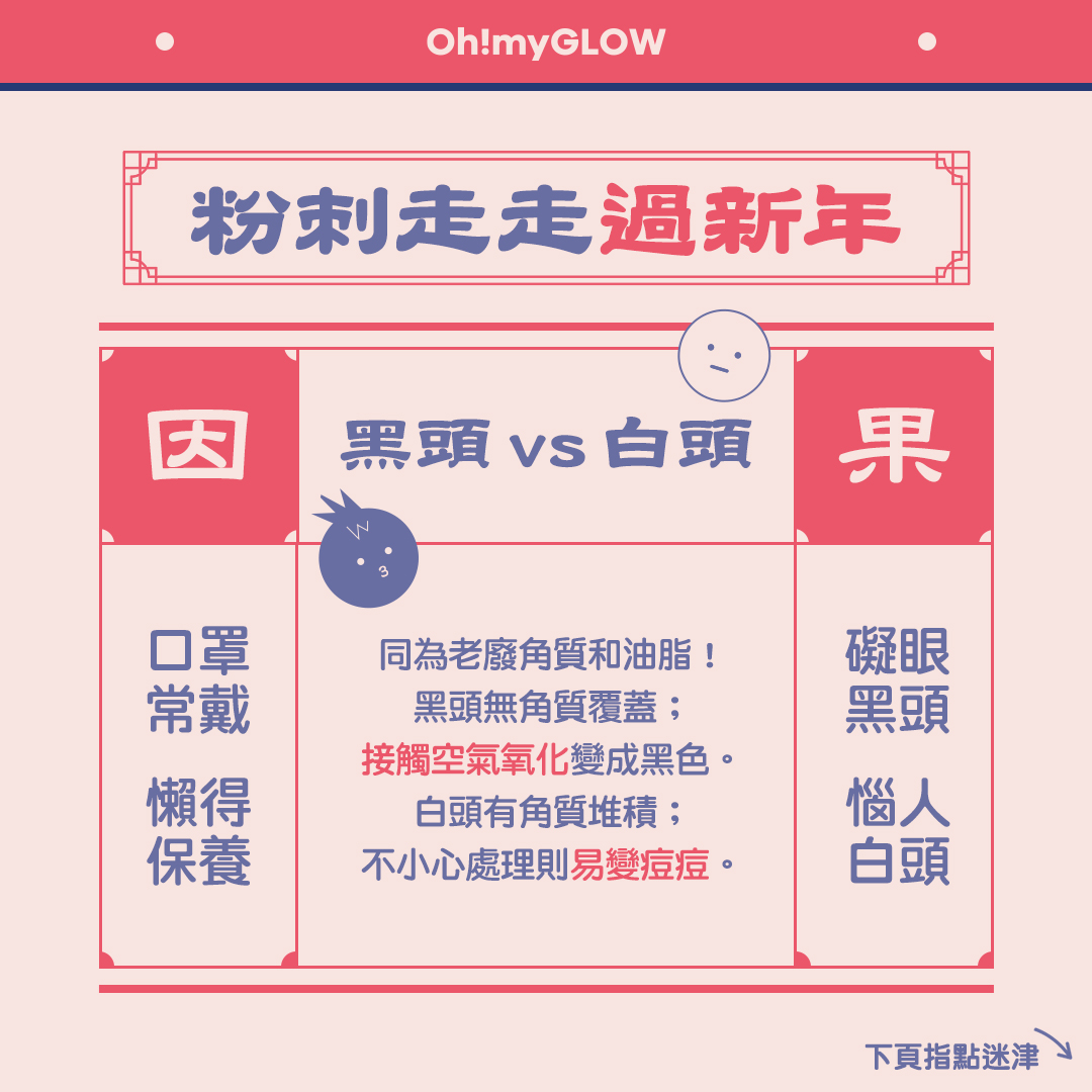 【新年大掃除】如何有效應付黑頭、白頭?
